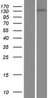 DGKD Human Over-expression Lysates NM_152879