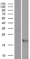 Cystatin F (CST7) Human Over-expression Lysates NM_003650