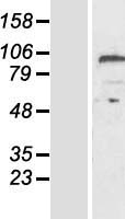 Carboxypeptidase Z (CPZ) Human Over-expression Lysates NM_001014448