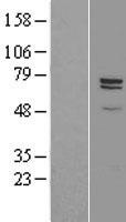 Carboxypeptidase Z (CPZ) Human Over-expression Lysates NM_003652