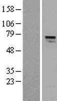 Alkyl DHAP synthase (AGPS) Human Over-expression Lysates NM_003659