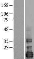 LMO4 Human Over-expression Lysates NM_006769