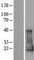 CGGBP1 Human Over-expression Lysates NM_001008390