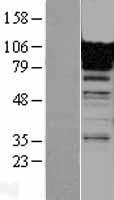 FCN3 Human Over-expression Lysates NM_173452
