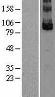 LGR5 Human Over-expression Lysates NM_003667
