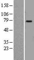PIAS1 Human Over-expression Lysates NM_016166
