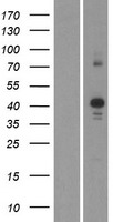 CDK10 Human Over-expression Lysates NM_052988