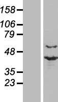 PRP18 homolog (PRPF18) Human Over-expression Lysates NM_003675