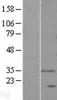 DEGS1 Human Over-expression Lysates NM_003676