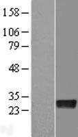 Density Regulated Protein (DENR) Human Over-expression Lysates NM_003677