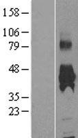 kynurenine 3 monooxygenase (KMO) Human Over-expression Lysates NM_003679