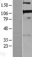 ls008572 ril pdlim4 human over expression lysates nm 003687 wb testing 1