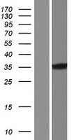 PRKRA Human Over-expression Lysates NM_001139517
