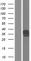 PRKRA Human Over-expression Lysates NM_001139518