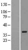PRKRA Human Over-expression Lysates NM_003690