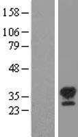 STK16 Human Over-expression Lysates NM_001008910