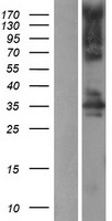 STK16 Human Over-expression Lysates NM_003691