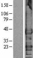 TMEFF1 Human Over-expression Lysates NM_003692
