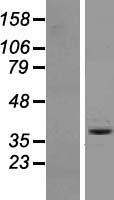 OR6A2 Human Over-expression Lysates NM_003696