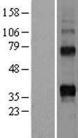 RANKL (TNFSF11) Human Over-expression Lysates NM_003701