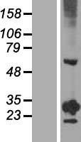 RGS20 Human Over-expression Lysates NM_003702