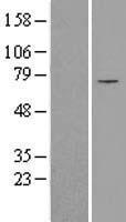 SLC25A12 Human Over-expression Lysates NM_003705