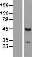 TIP49A (RUVBL1) Human Over-expression Lysates NM_003707