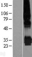 ls008612 ppap2c plpp2 human over expression lysates nm 003712 wb testing 1