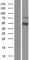 ASMTL Human Over-expression Lysates NM_001173474