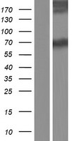 ASMTL Human Over-expression Lysates NM_004192