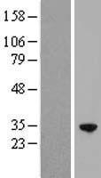 RFXANK Human Over-expression Lysates NM_003721