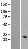 RFXANK Human Over-expression Lysates NM_134440