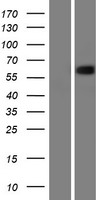 p63 (TP63) Human Over-expression Lysates NM_001114978