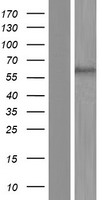p63 (TP63) Human Over-expression Lysates NM_001114979