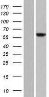 JRK Human Over-expression Lysates NM_001077527
