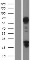 JRK Human Over-expression Lysates NM_003724