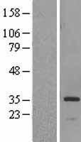 HSD17B6 Human Over-expression Lysates NM_003725