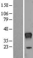 Ribonuclease T2 (RNASET2) Human Over-expression Lysates NM_003730