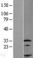 SSNA1 Human Over-expression Lysates NM_003731