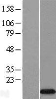 EIF4EBP3 Human Over-expression Lysates NM_003732
