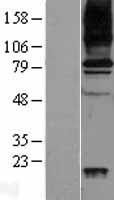 VAP1 (AOC3) Human Over-expression Lysates NM_003734