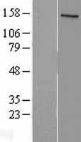 NCOA1 Human Over-expression Lysates NM_003743