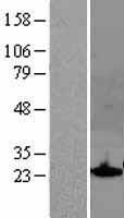 SOCS1 Human Over-expression Lysates NM_003745