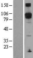 PDE5A Human Over-expression Lysates NM_033430