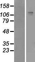 IRS2 Human Over-expression Lysates NM_003749