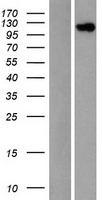 eIF3s8 (EIF3C) Human Over-expression Lysates NM_003752