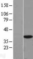 EIF3S2 (EIF3I) Human Over-expression Lysates NM_003757