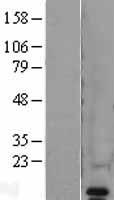 VAMP8 Human Over-expression Lysates NM_003761