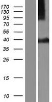 ls008675 syntaxin 16 stx16 human over expression lysates nm 001001433 wb testing 1