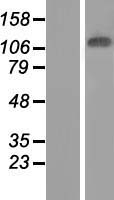 ls008681 jmjd7 pla2g4b human over expression lysates nm 005090 wb testing 1